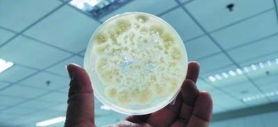 在南京百斯杰生物工程有限公司分子生物学研究院里，原本在显微镜下才能看得到的细菌、真菌，在圆形的培养皿中呈现出固态形状。 南报融媒体记者 徐宁摄